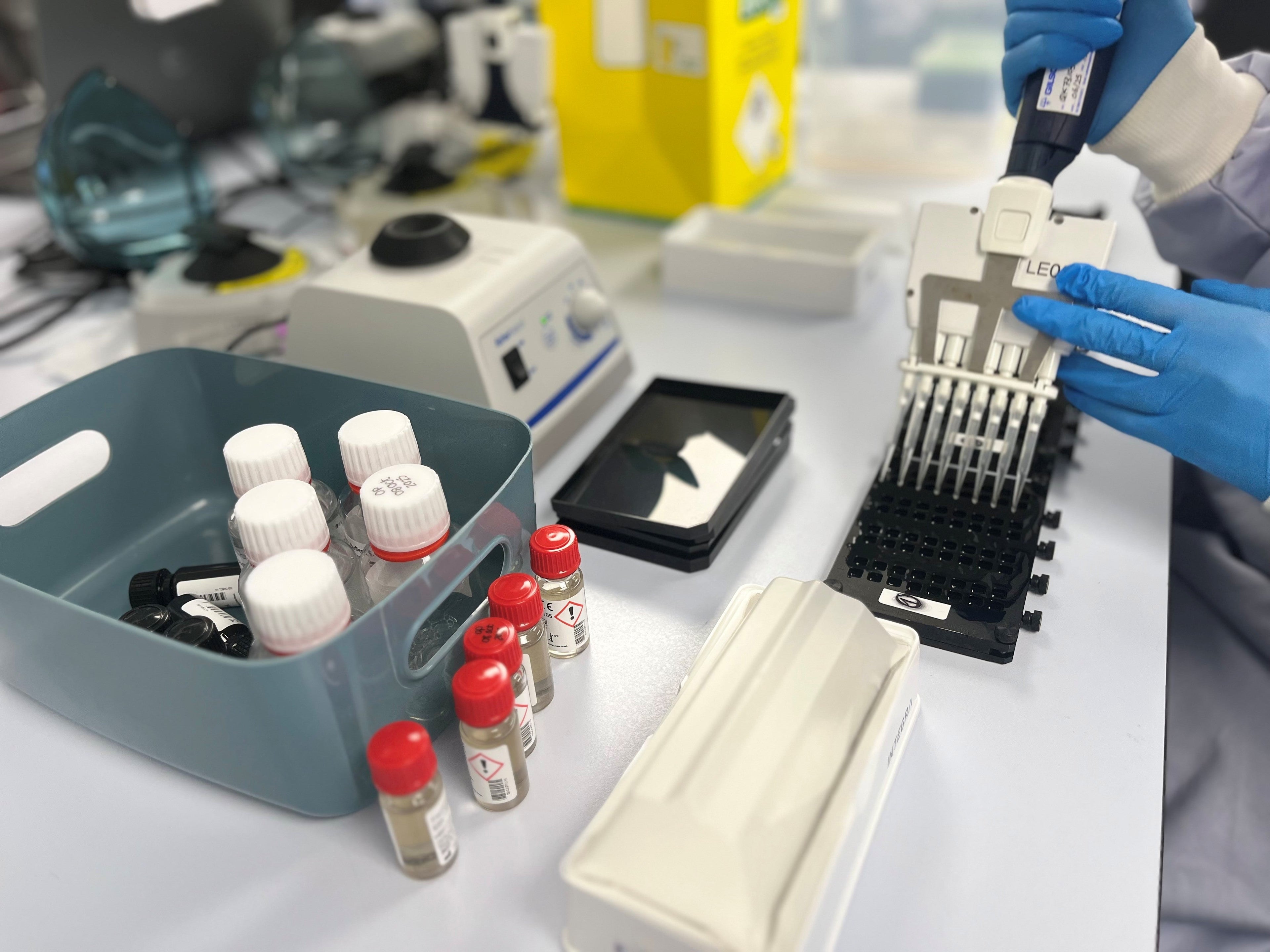 Why Microarray Technology Offers Advantages Over Traditional ELISA for Large Food Sensitivity Panels